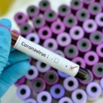 110 persoane confirmate cu noul coronavirus, în județul Arad